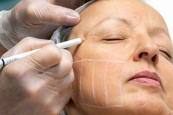 CryoPen: 5 Skin Concerns It May Be Used to Treat 4 What should you ask before having CryoPen treatment England?