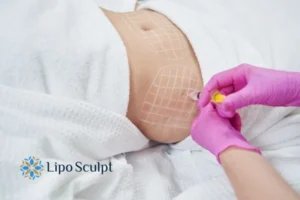 Are The Results From Aqualyx Permanent? 1 Do you want to know how long Aqualyx England results last?