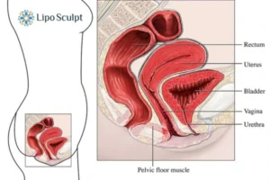 Treatment For A Leaky Bladder 2 How EM Chair treatment England can help Leaky bladder issues. Read more now!