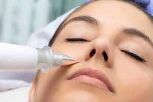 Best Actinic Keratoses Removal 3 Actinic keratoses England solutions - book in today!