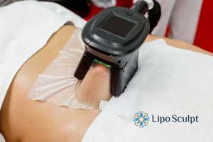 Does Fat Freezing At Home Work? 3 Fat freezing at home from Lipo Sculpt England